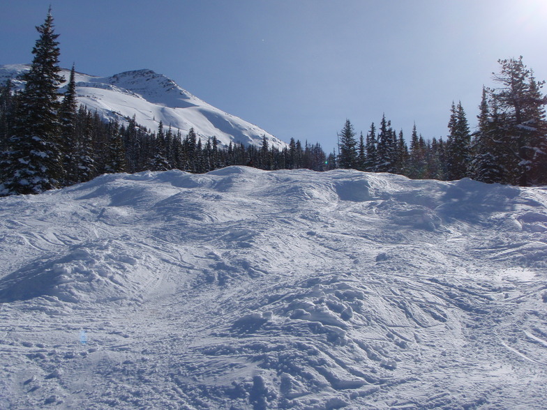 And it gets better., Lake Louise